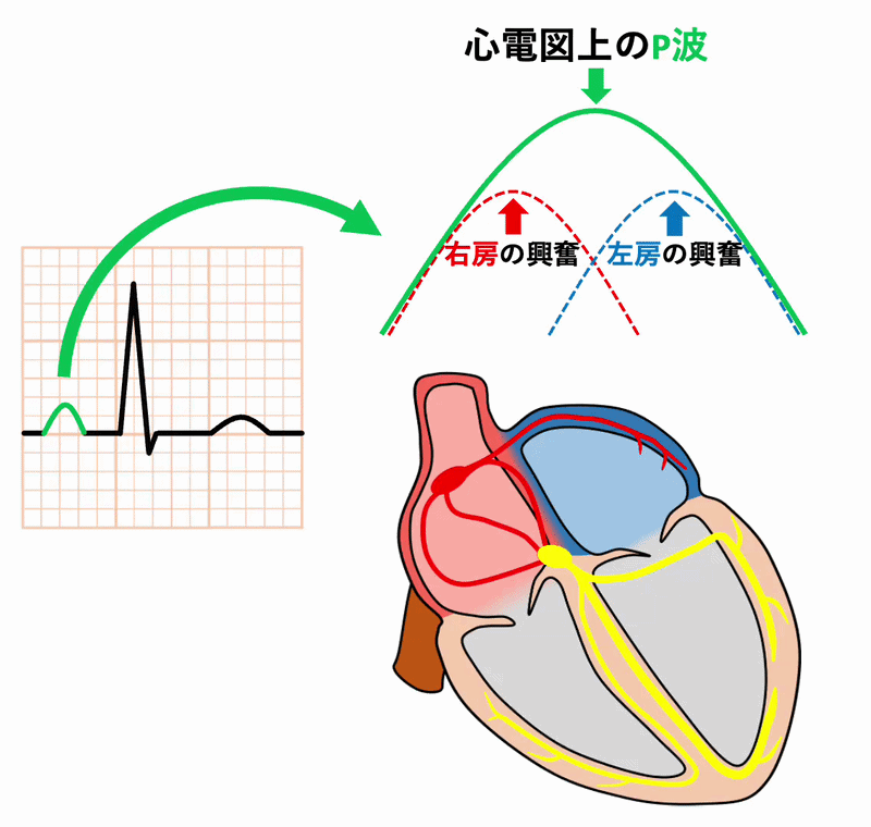 P波(P wave)
P波は1つの波形に見えますが、右房の興奮波と左房の興奮波を合わせてできた波形です。前半2/3が右房の興奮、後半2/3が左房の興奮になります。