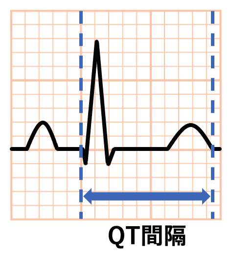 QT間隔(QT interval)