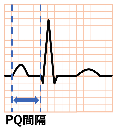 PQ間隔