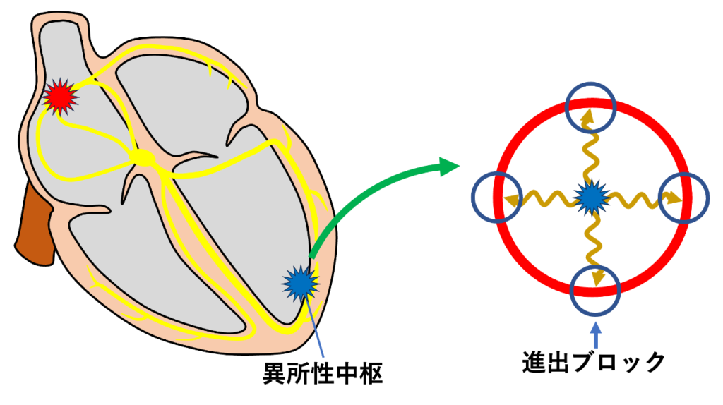 副収縮(Parasystole)