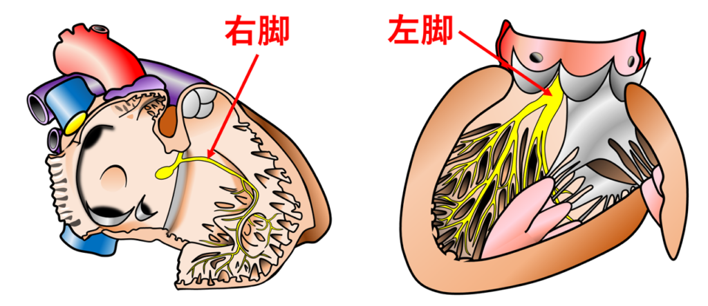 右脚ブロック(right bundle branch block:RBBB)
右脚は元々ブロックになりやすく、健康な人の中にも1~3%程度認めます。右脚は1本の線維であるのに対して左脚は網目状の線維構造になっており、さらに右脚は左脚に比べると細いため伝導障害が生じやすくなってます