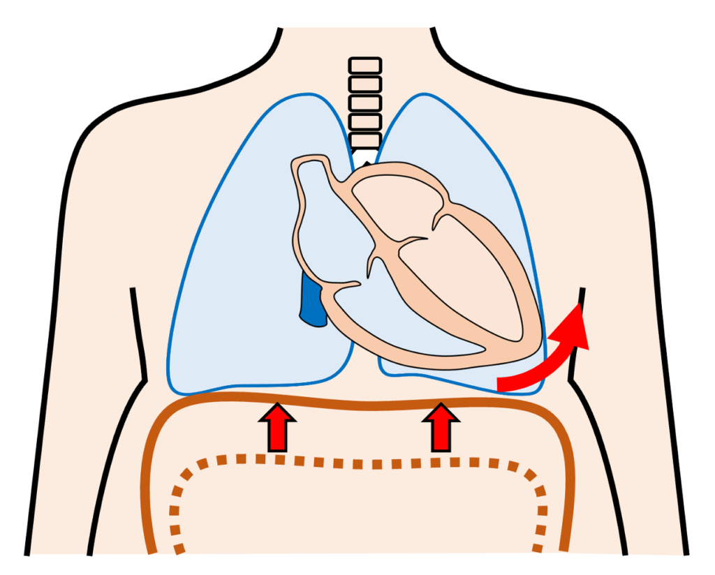 時計方向回転(clockwise rotation)
肥満では腹部脂肪の増加により横隔膜が押し上げられ、心臓が横向き(横位心)になります。この位置変化が、胸部誘導の移行帯を時計方向にずらす要因になるとされています。