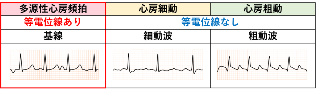 多源性心房頻拍(multifocal atrial tachycardia：MAT)
さらに、PP間隔が不規則で、P波間のベースラインが等電位であることが基準に含まれることもあります。これは心房細動や心房粗動と区別するためです。また、心拍数が100回/分未満になると多源性心房調律と呼ばれます