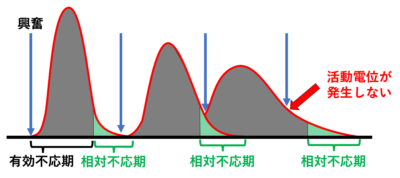 Wenckebach現象(Wenckebach phenomenon)