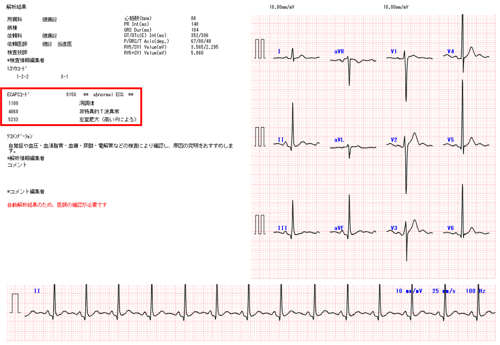 肺血栓塞栓症 心電図 Com
