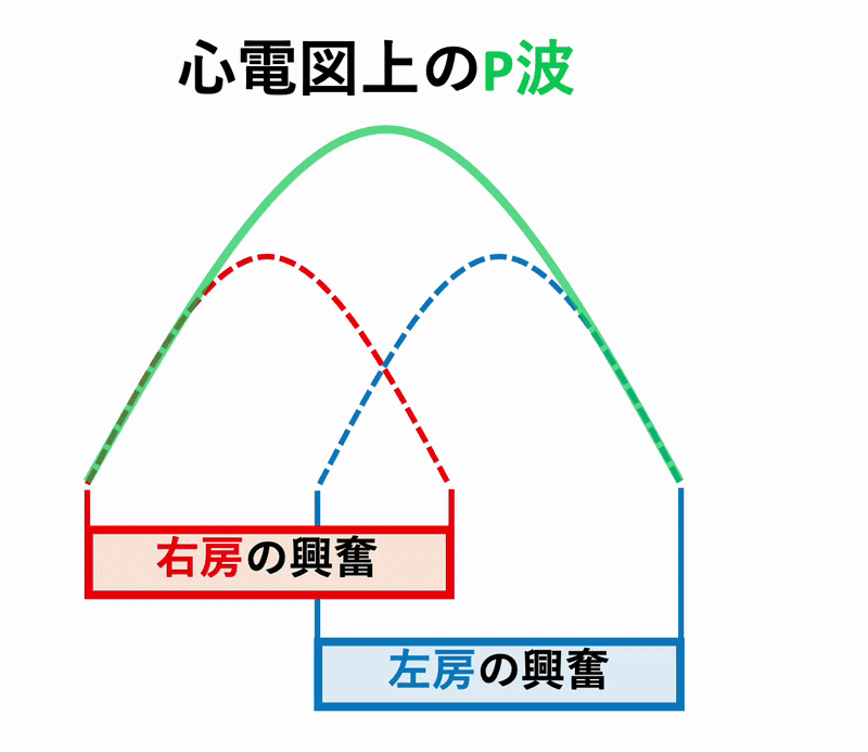 僧帽性P波(P mitrale)