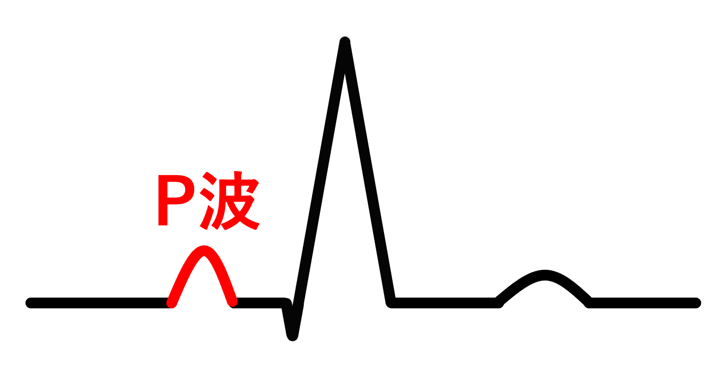心电图p波正常值_39健康网_精编内容