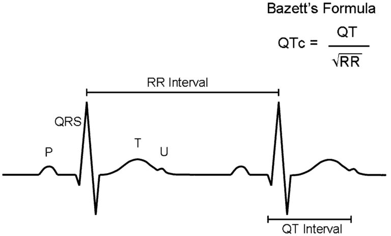 QTcとは？ | 心電図.com