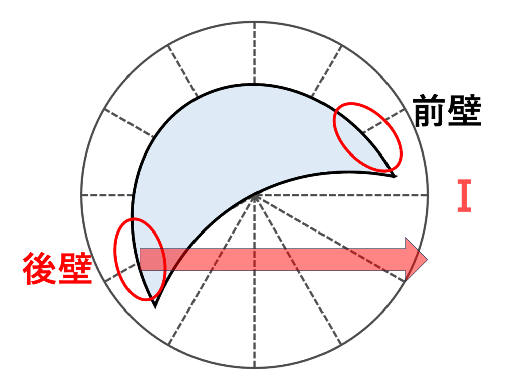 右室流出路起源