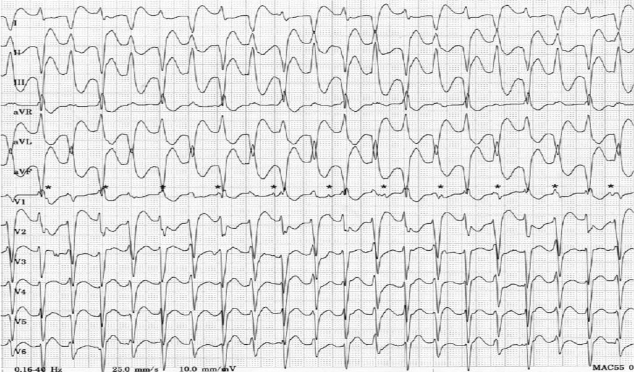 心臓はどのように機能するのでしょうか?