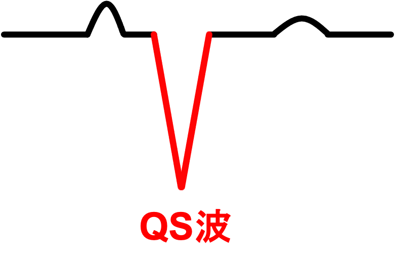 QS波