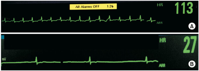原因と危険因子