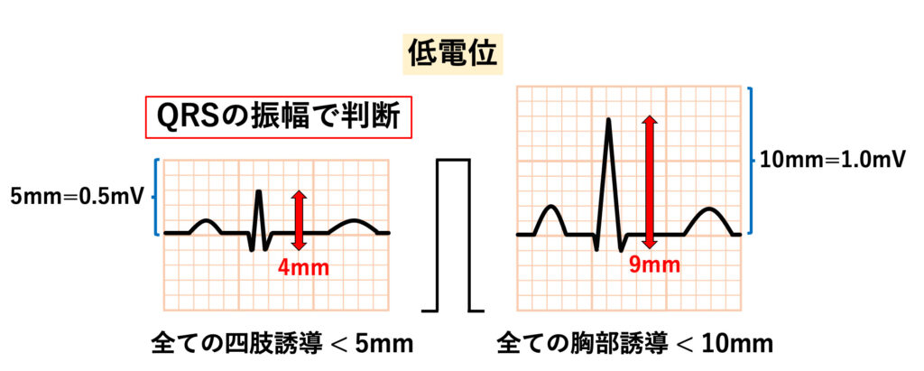 低電位