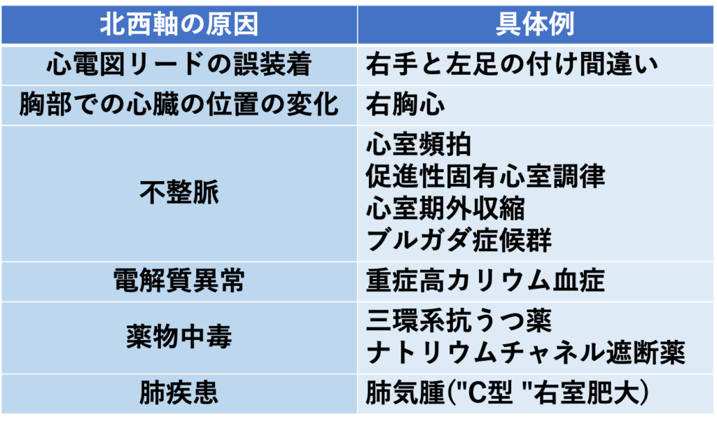 北西軸(northwest QRS axis)