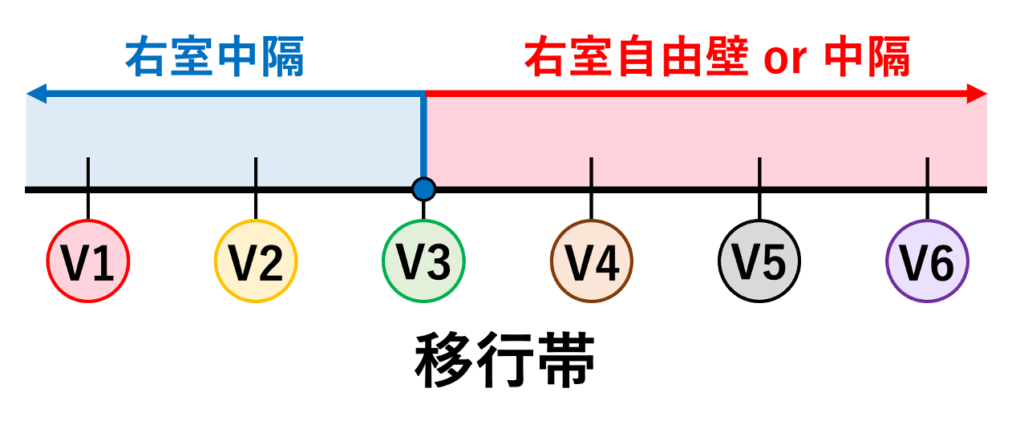 EASY-WPW
そのため移行帯が>V3であれば移行帯が遅い、つまり右室自由壁側から興奮が始まっている、移行帯が≤V3であれば移行帯が早い、つまり右室中隔側から興奮が始まっていると考えることができます。ただし、移行帯が>V3でも右室中隔側からの興奮の場合があるので、この場合は移行帯のみでは鑑別しません。