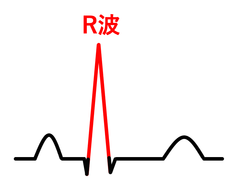 R波