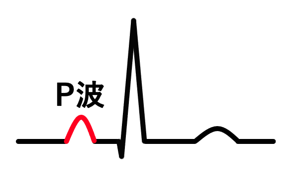 P波(P wave)