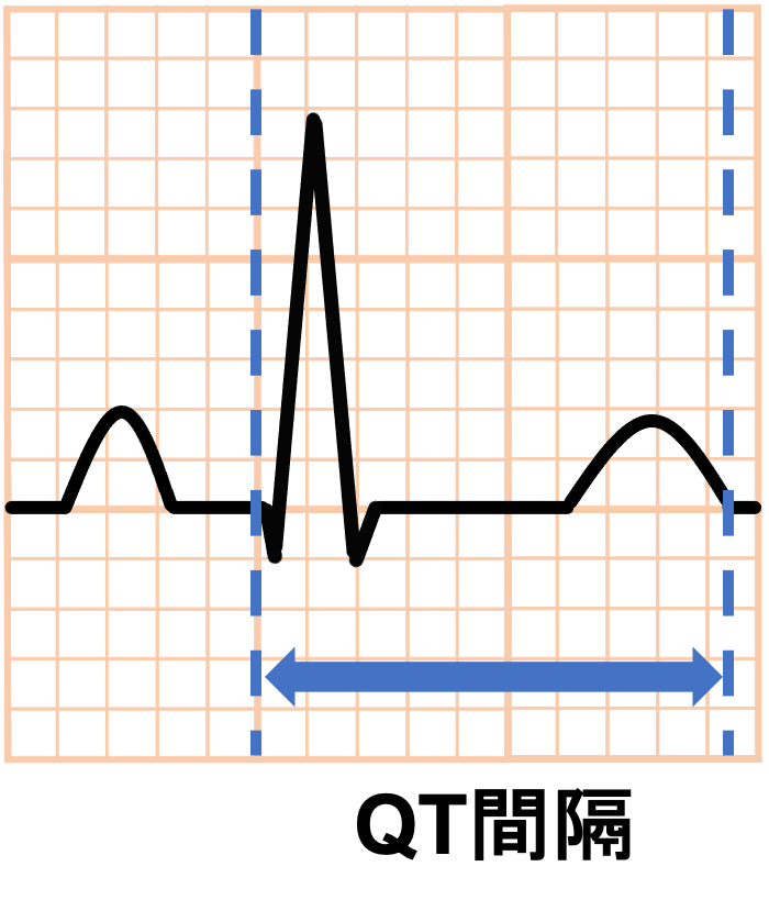 QT間隔(QT interval)