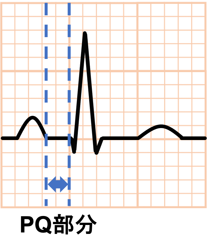 PQ部分(PQ segment)