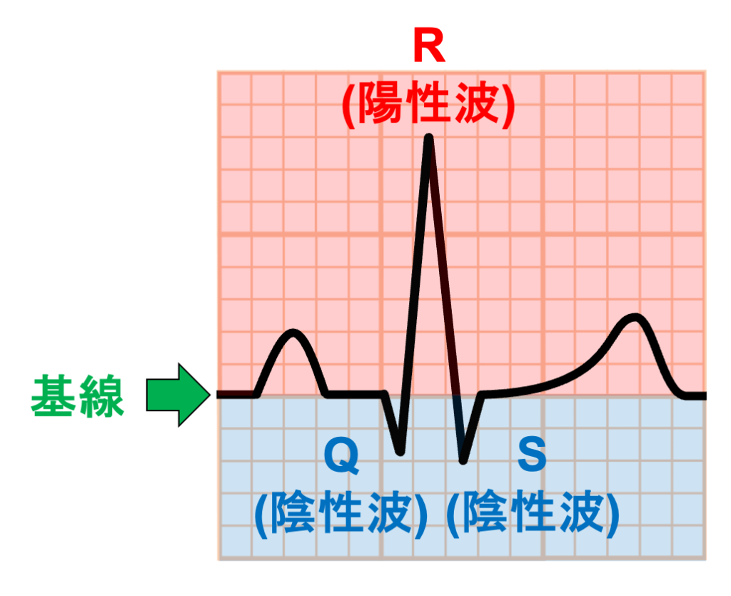QRS波の命名法
