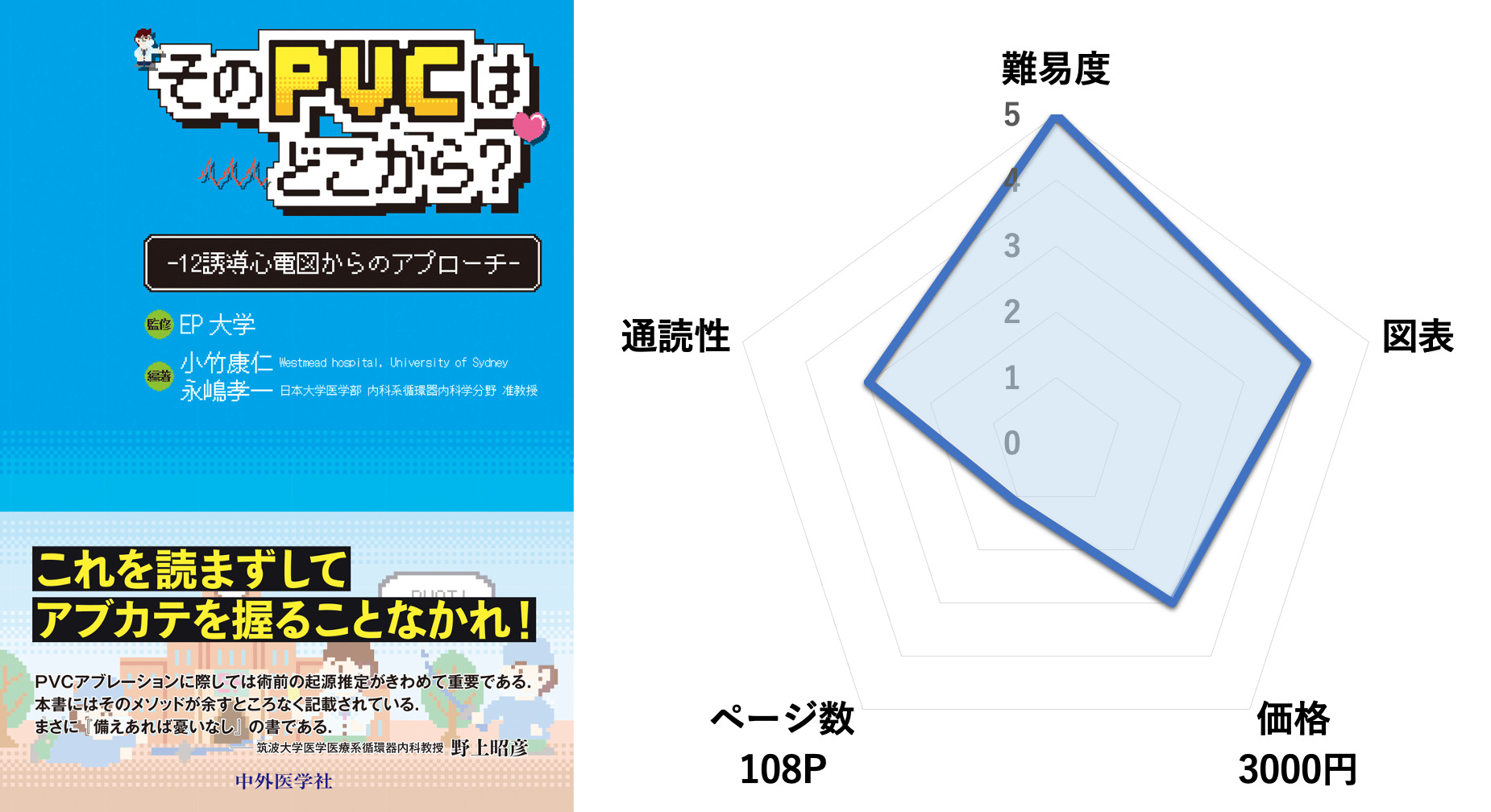 そのPVCはどこから -12誘導心電図からのアプローチ