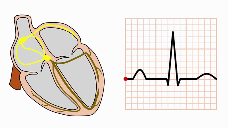pseudo‐supernormal conduction