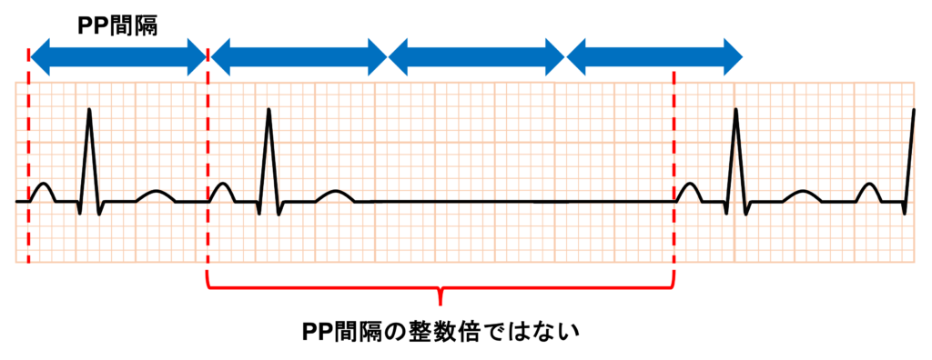 洞停止(sinus arrest)