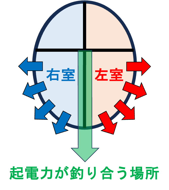 移行帯(transitional zone)