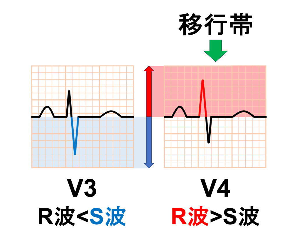 移行帯(transitional zone)