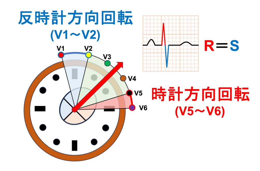 移行帯(transitional zone)