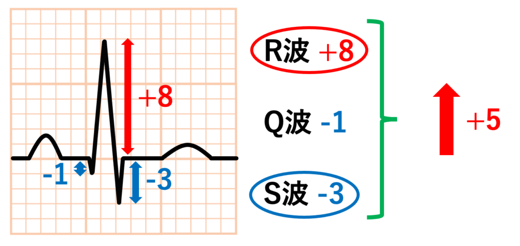 電気軸(electrical axis)