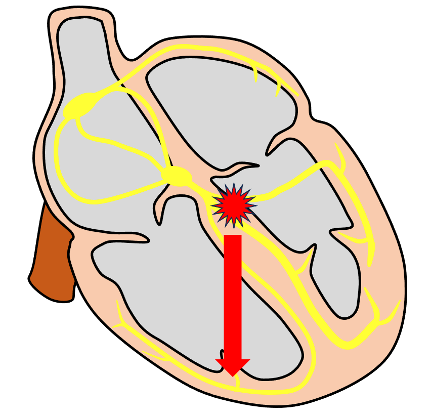 下方軸(inferior axis)