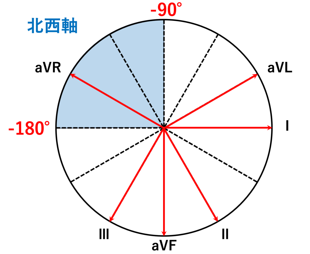 北西軸(northwest QRS axis)