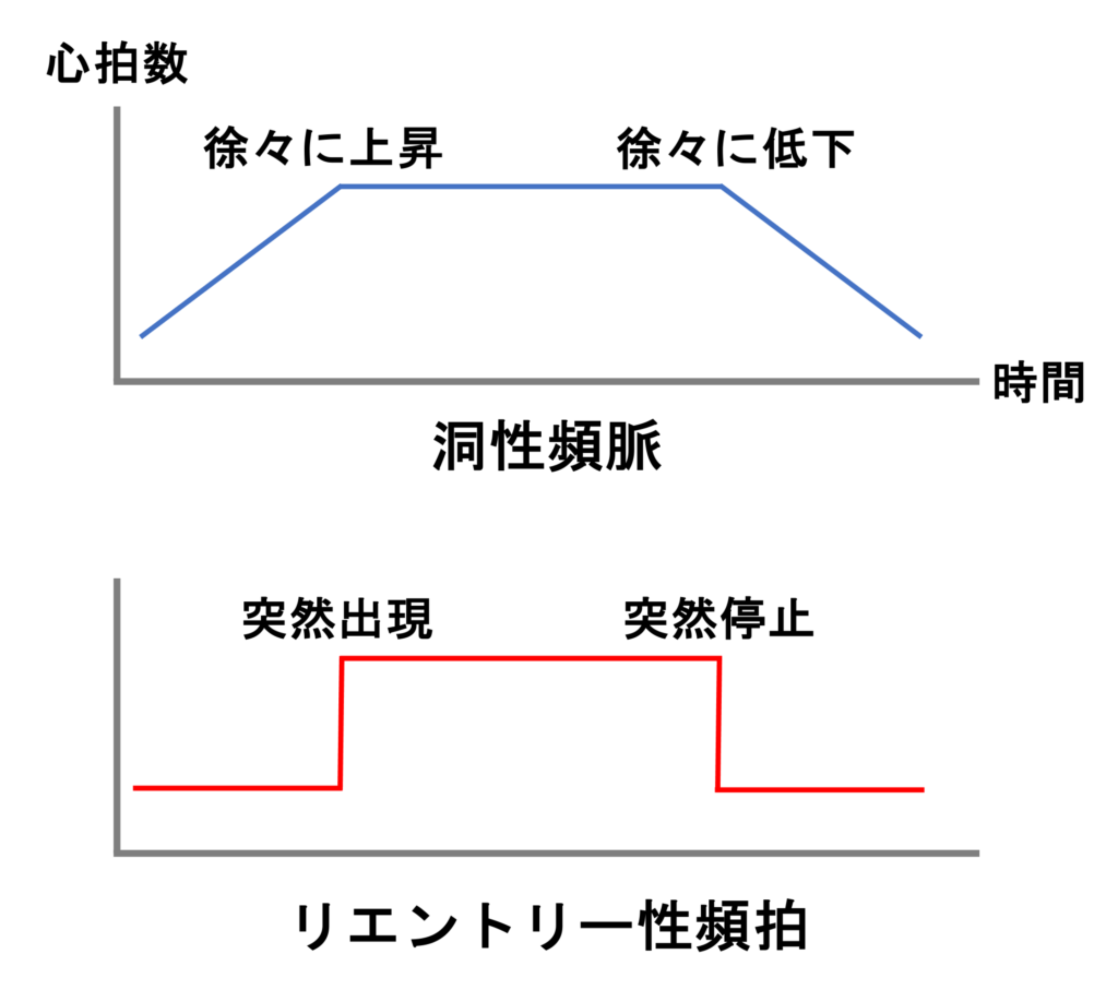 洞性頻脈(Sinus tachycardia)