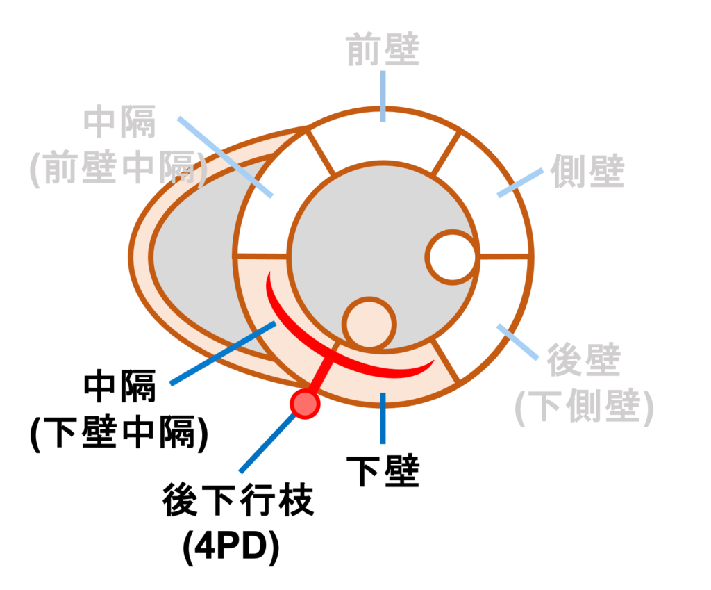 下壁心筋梗塞(inferior myocardial infarction)