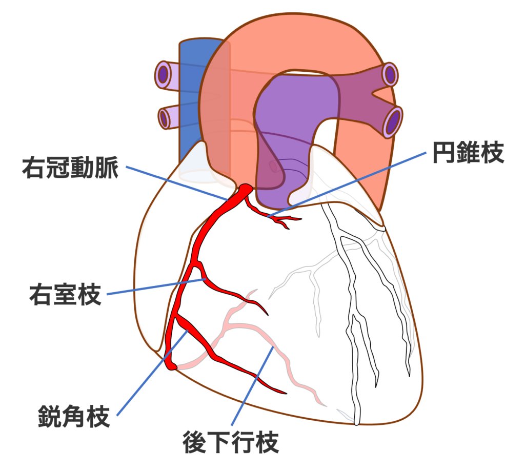 右室梗塞(right ventricular infarction)