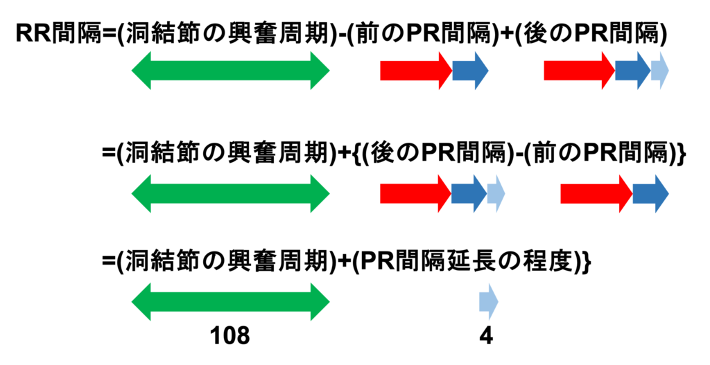 Wenckebach現象(Wenckebach phenomenon)