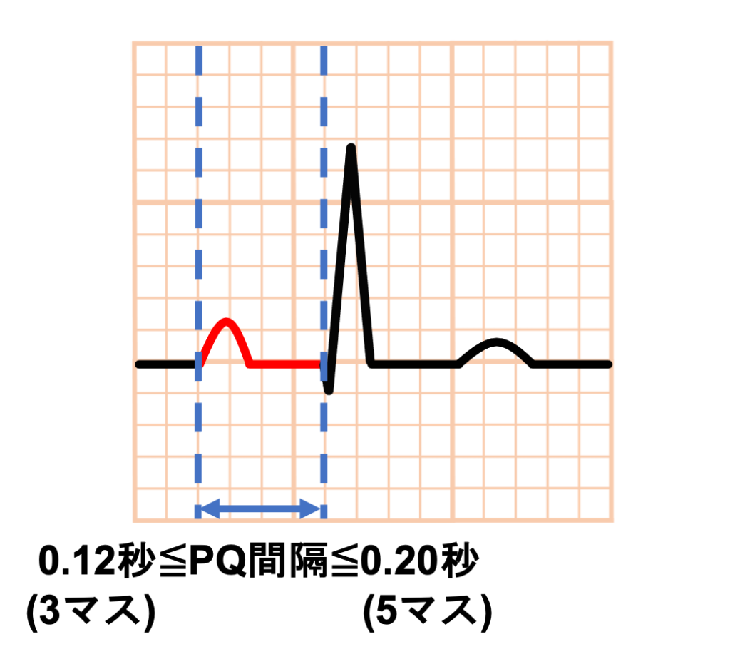 PQ間隔(PQ interval)