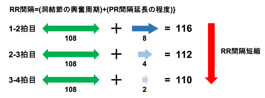 Wenckebach現象(Wenckebach phenomenon)