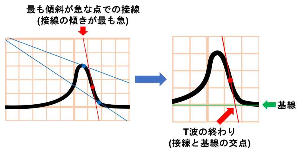 QT間隔(QT interval)