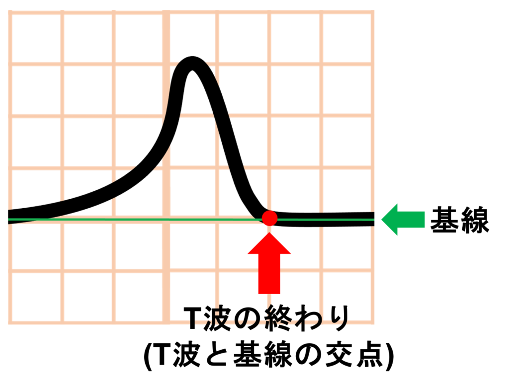 QT間隔(QT interval)