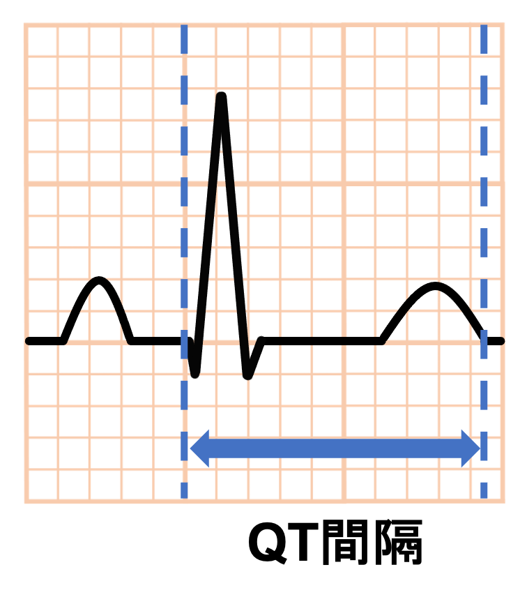 QT間隔(QT interval)