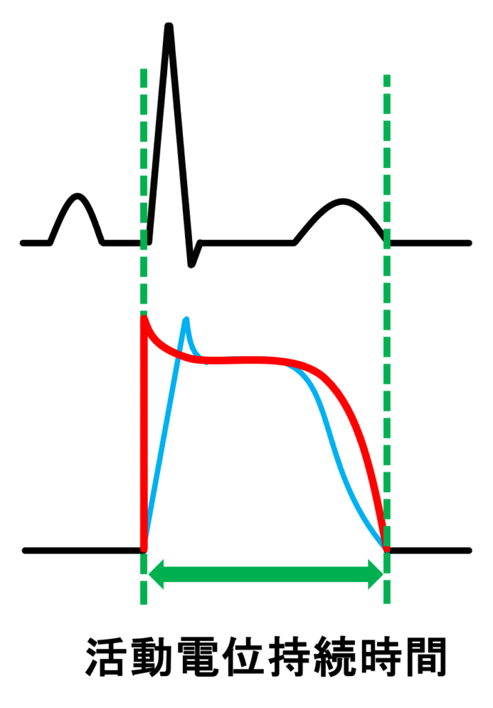 QT間隔(QT interval)