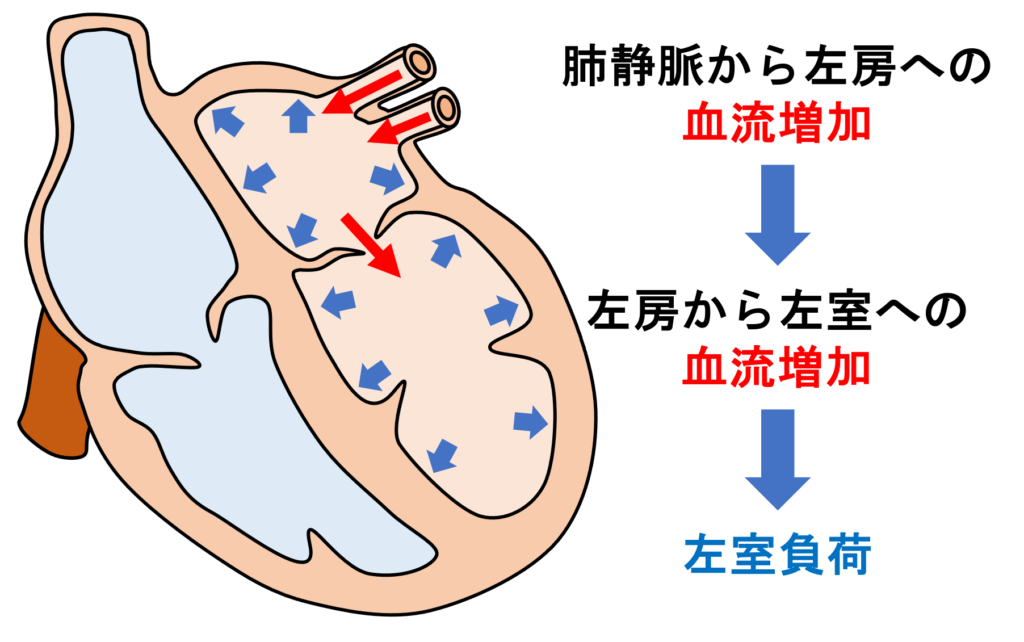 動脈管開存症(patent ductus ateriosus)