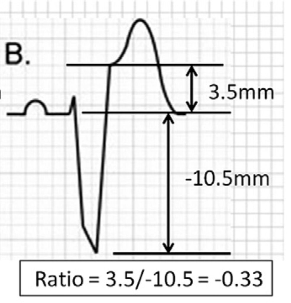 Smith's Criteria