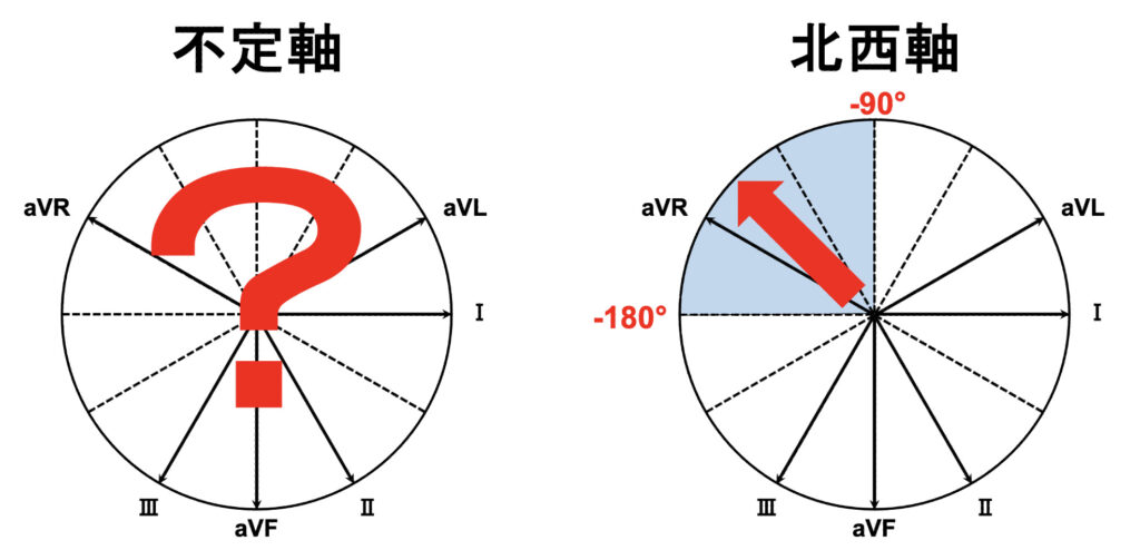 不定軸(indeterminate axis)