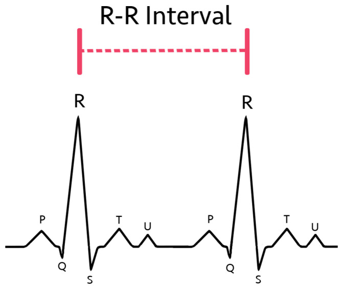 RR間隔(RR Interval)