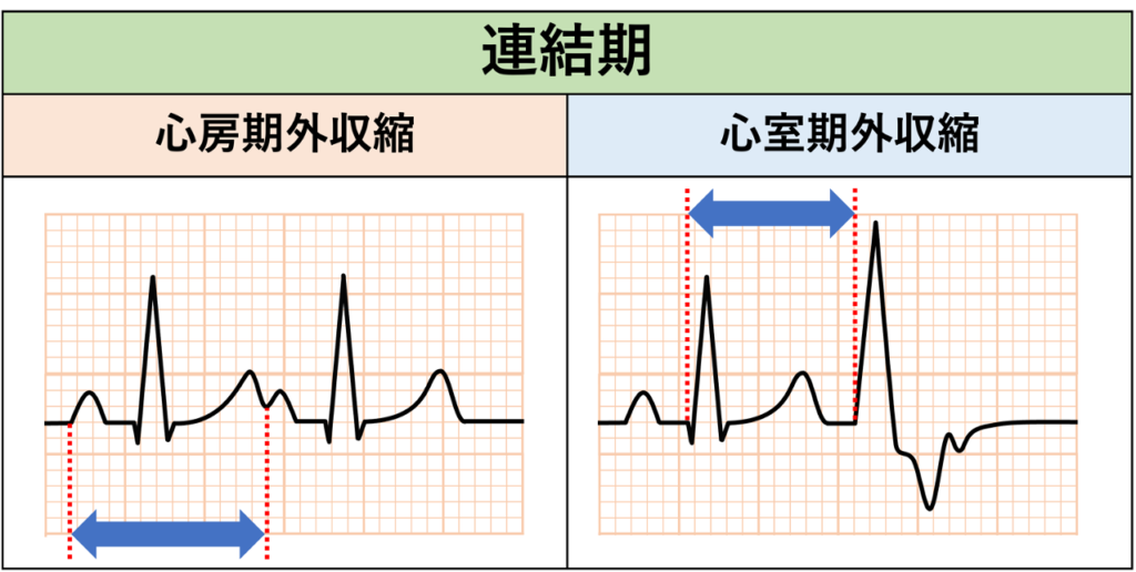 連結期(coupling interval)
連結期とは期外収縮とその直前の基本調律の心拍との間の距離のことです。連結期は上室期外収縮と心室期外収縮の両方で用いられます