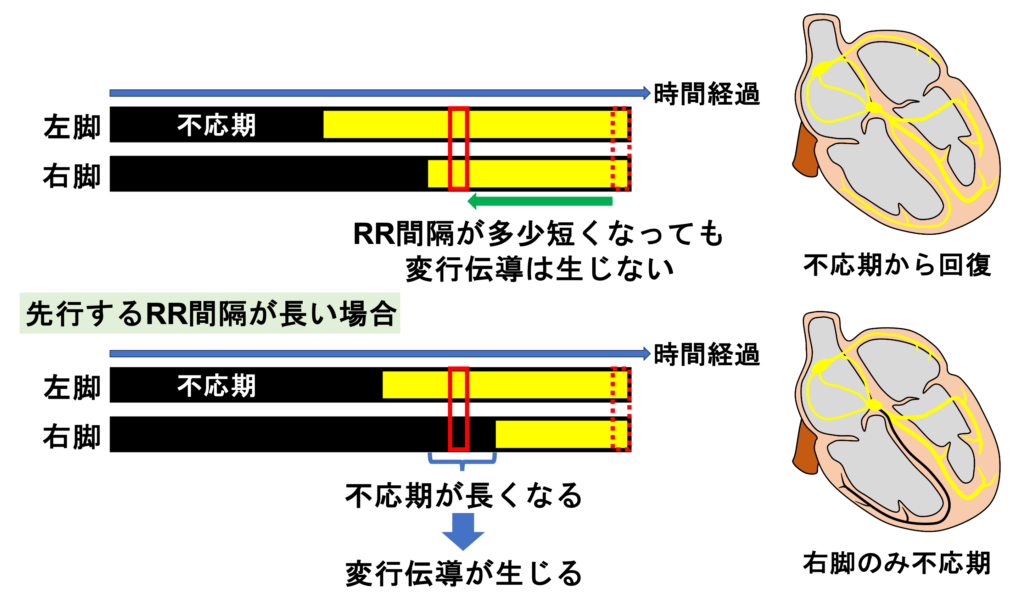 Ashman現象(Ashman phenomenon)