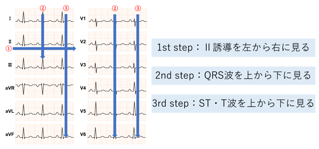 3秒で心電図を読む本